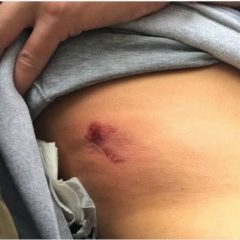 Suite aux agressions subies par les journalistes, les syndicats demandent une rencontre urgente avec le Ministre de l’Intérieur